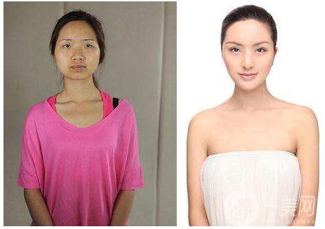 彩光嫩膚有用嗎 術(shù)后護(hù)理簡(jiǎn)析