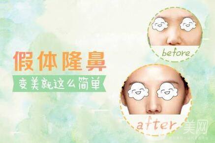 硅膠隆鼻可以維持一生嗎？