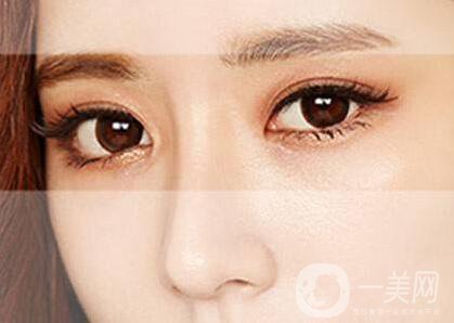 *術(shù)后注意事項有哪些？