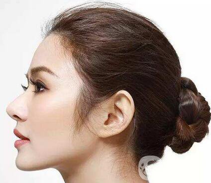 隆鼻能保持一輩子嗎？