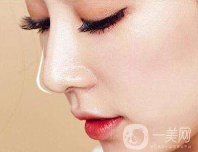 隆鼻能保持一輩子嗎？