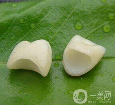 金鈀合金烤瓷牙價格多少錢？