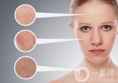 黃褐斑的形成原因是什么？