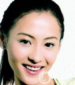 上海鈷鉻烤瓷牙價格一般是多少錢