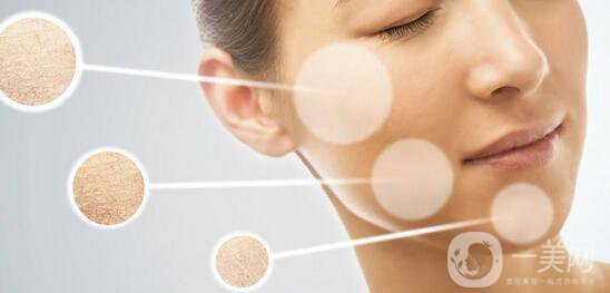 花斑癬調(diào)節(jié)方法有哪些？