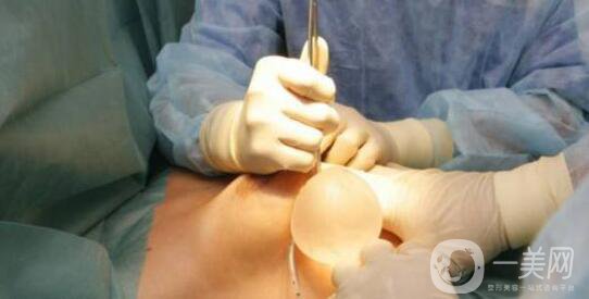 廣東,隆胸,價格