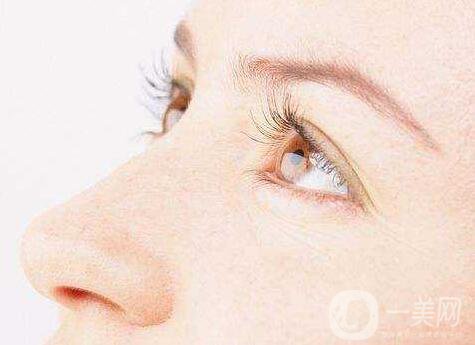 埋線雙眼皮5天能消腫嗎？