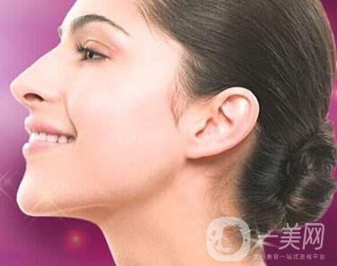 雙下巴吸脂多少錢？價格盤點！