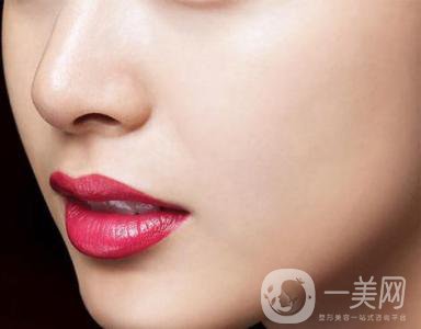 鼻小柱延長整形手術之后多久恢復正常