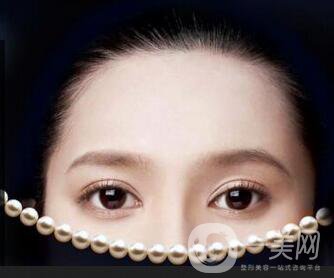 全切雙眼皮恢復(fù)過程一般是怎樣的 要注意些什么