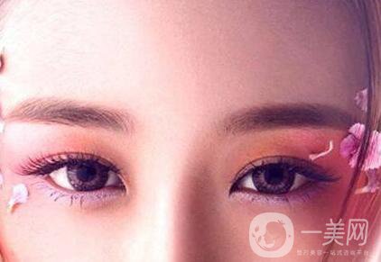 開內(nèi)眼角多久恢復(fù)自然？