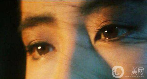 割雙眼皮,北京割雙眼皮,割雙眼皮介紹