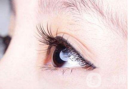 開眼角,開眼角增生,眼角增生修復費用