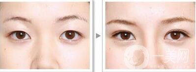 *手術前準備有哪些