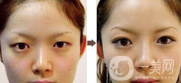 *手術前準備有哪些