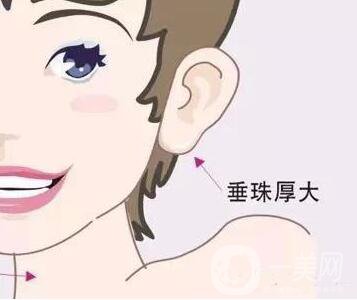 玻尿酸豐耳垂,玻尿酸豐耳垂多少錢,上海玻尿酸豐耳垂多少錢