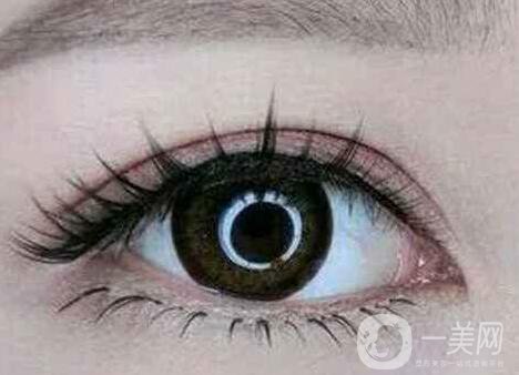 上海開眼角手術的費用是多少？