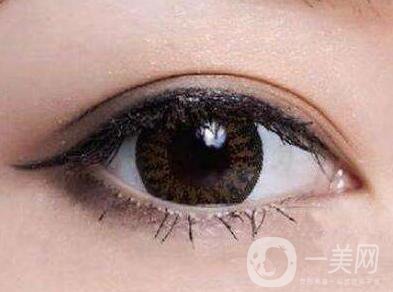 上海開眼角手術的費用是多少？