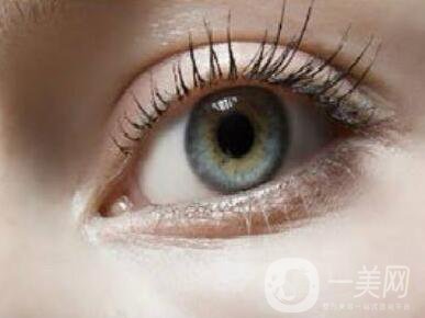 割雙眼皮變化大嗎？