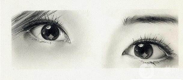 割雙眼皮術(shù),雙眼皮術(shù)后注意事項(xiàng)