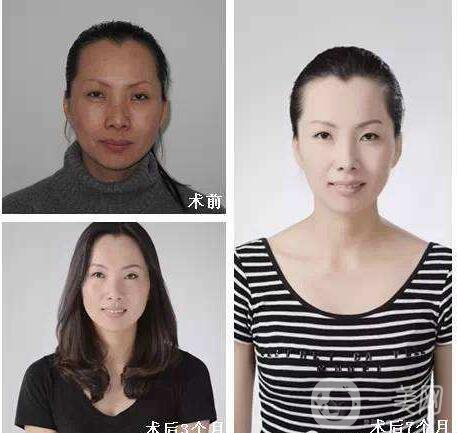 熱瑪吉,熱瑪吉價(jià)格,上海熱瑪吉價(jià)格