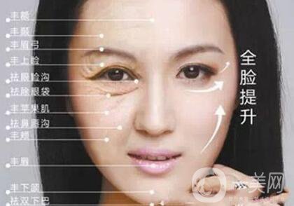 電波拉皮多長時間做一次？