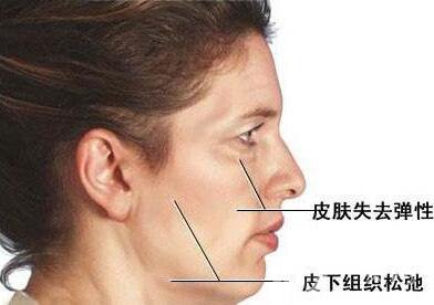 電波拉皮*果嗎？
