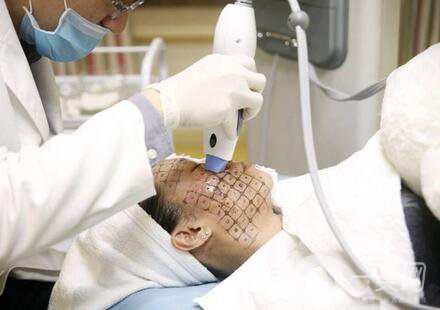 北京整形熱瑪吉拉皮價(jià)格要多少錢？