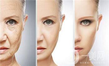 北京整形熱瑪吉拉皮價(jià)格要多少錢？