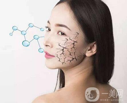 冰電波拉皮價(jià)格是多少？