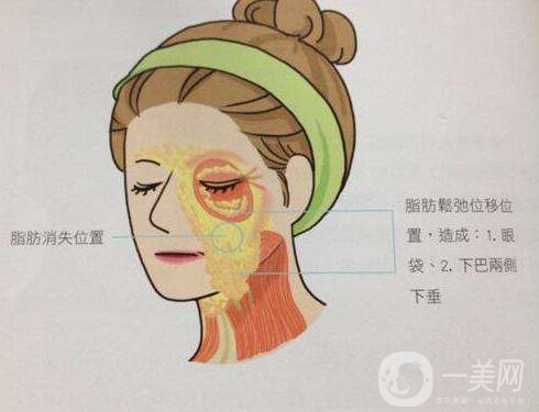 電波拉皮手,電波拉皮手術(shù)多少錢,成都電波拉皮手術(shù)多少錢