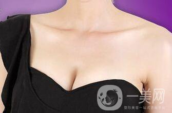 假體豐胸恢復期多久？