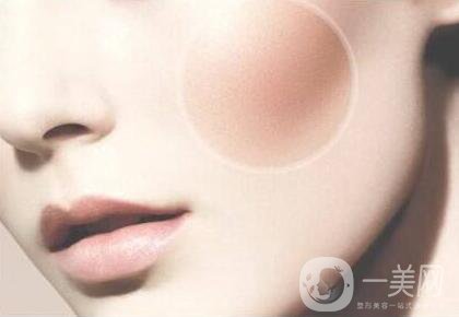 顴骨肉怎么消？怎么縮小顴骨？