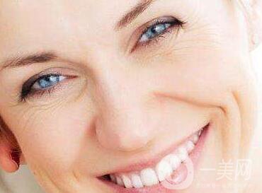 自體脂肪去法令紋怎么樣？