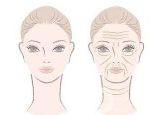 *去眉間紋,深圳*去眉間紋多少錢,*去眉間紋注意事項