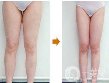 西安*的價格一般是多少錢