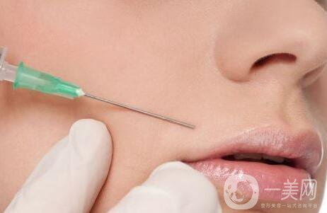 玻尿酸去法令紋,深圳玻尿酸去法令紋價(jià)格