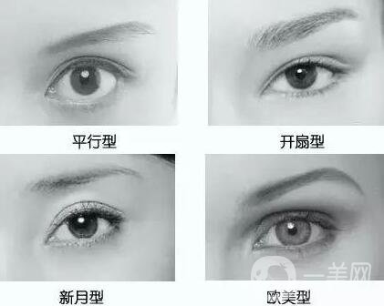 做韓式*雙眼皮術(shù)的優(yōu)點(diǎn)有哪些？