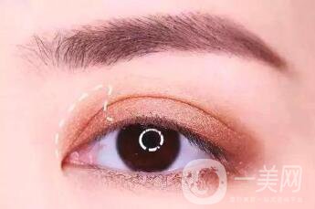 割雙眼皮的高度一般是多少呢