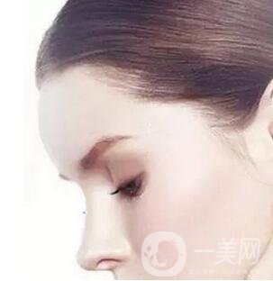 玻尿酸豐額頭維持多久？