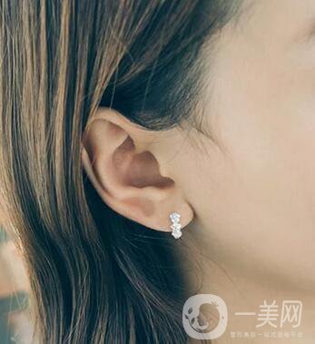 自體脂肪豐耳垂術(shù)后護(hù)理