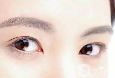 玻尿酸豐眉弓*嗎？