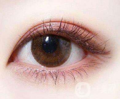 怎樣判斷雙眼皮增生了呢？