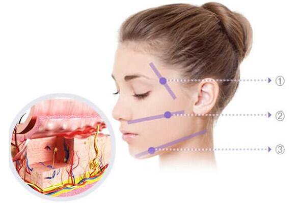 成都熱瑪吉多少錢,熱瑪吉注意事項