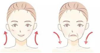 寧波手術(shù)去法令紋多少錢