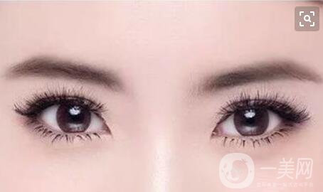 埋線雙眼皮維持多久,埋線雙眼皮術(shù)后護(hù)理