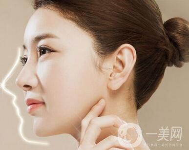 肋骨隆鼻多久可以修復(fù)？