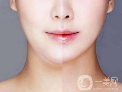 光纖溶脂減肥的危害主要有哪些？