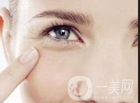 玻尿酸去魚尾紋*果好嗎