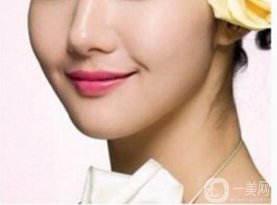 北京膨體墊下巴多少錢,膨體墊下巴注意事項(xiàng)